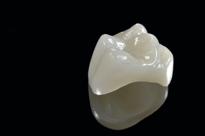 cerec-crowns-maine-lisbon-dentist-tooth-replacement-cap
